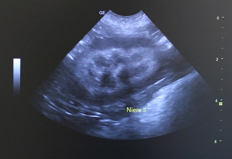 Ultraschall vorsorge Untersuchung Niere